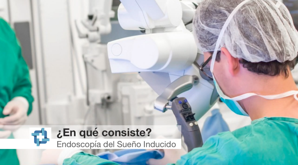 ¿Qué es la endoscopía de sueño inducido?