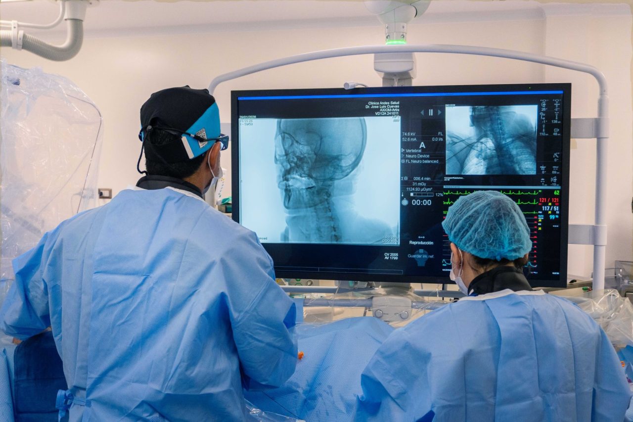 Cirugía endovascular de aneurisma: Procedimiento mínimamente invasivo con rápida recuperación en Andes Salud Puerto Montt.