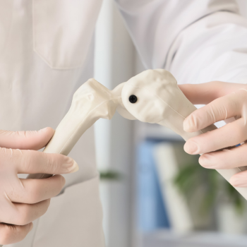 Consultas médica Traumatología: Artrosis y Artritis, Desgaste articular, Lesiones de Columna, hernias del núcleo pulposo, Traumatismos, Fracturas, luxaciones y esguinces provocados por golpes o caídas, tendinitis, roturas de ligamentos y desgarros musculares.