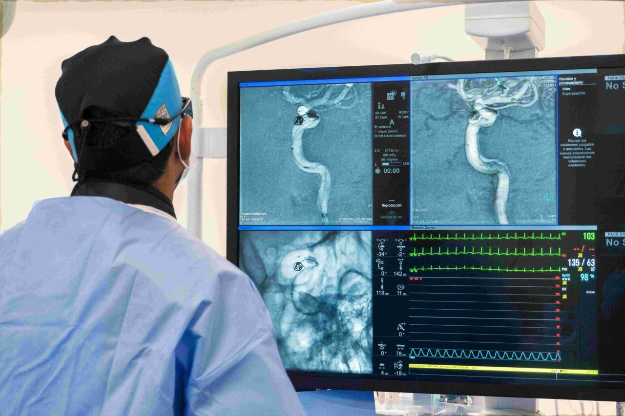 Especialista en neurocirugía en tratamiento endovascular para aneurisma cerebral. Bono PAD Fonasa Región de los Lagos