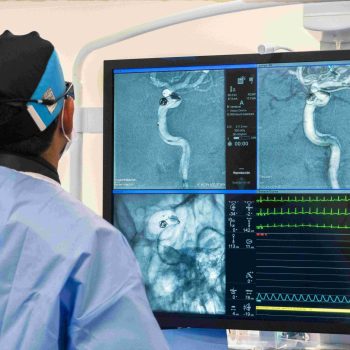 Especialista en neurocirugía en tratamiento endovascular para aneurisma cerebral. Bono PAD Fonasa Región de los Lagos