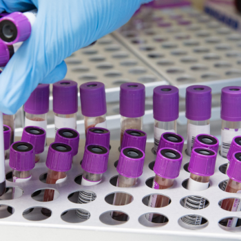 Exámenes de laboratorio en Clínica Andes Salud Puerto Montt, Centros Médicos en Puerto Montt, Calbuco, Frutillar, Llanquihue y Ancud.