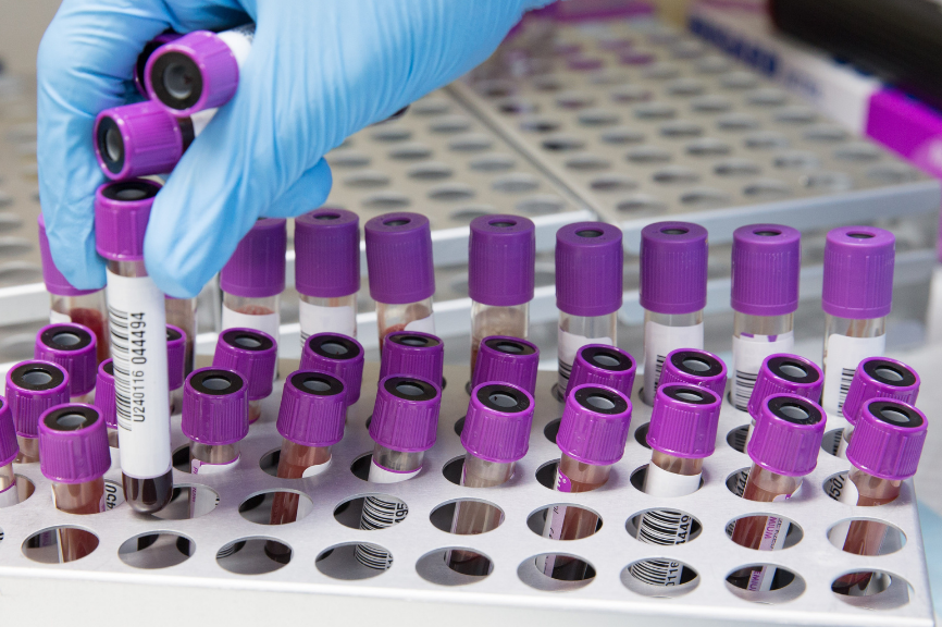 Exámenes de laboratorio en Clínica Andes Salud Puerto Montt, Centros Médicos en Puerto Montt, Calbuco, Frutillar, Llanquihue y Ancud.